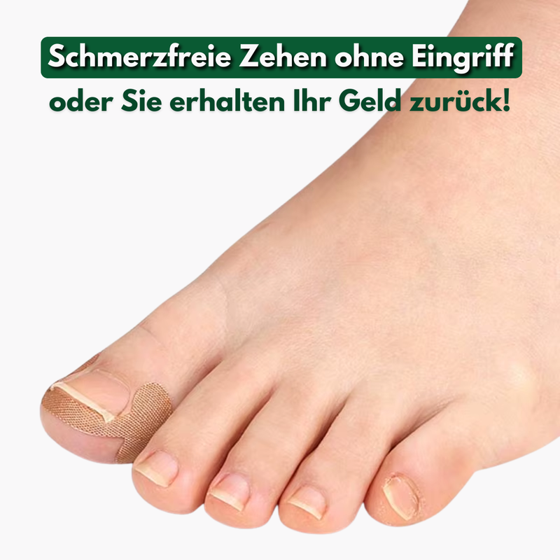 OrthoToe – Komplett-Set gegen eingewachsene Zehennägel